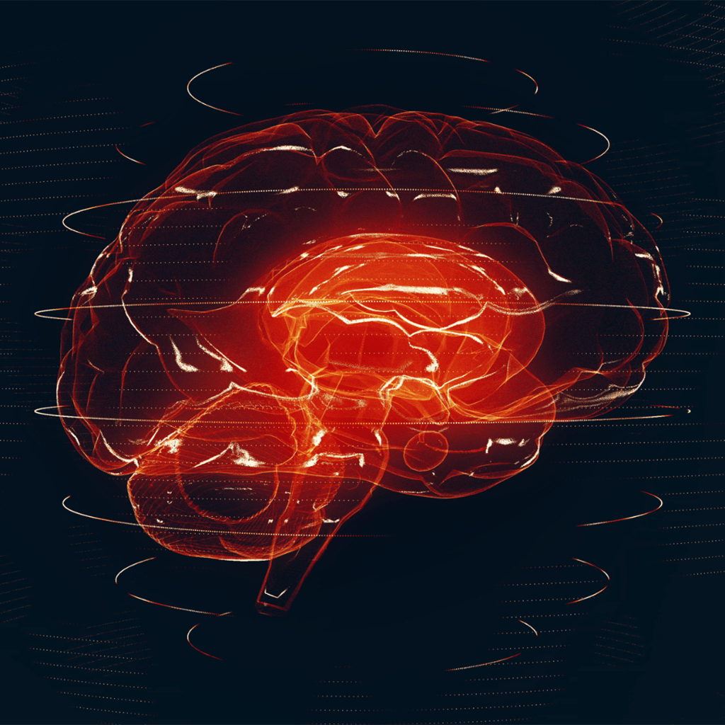Strength Training for Parkinson's Disease Brain Anatomy