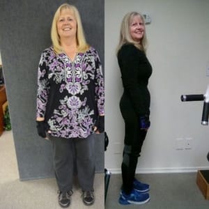 before and after results from a female client