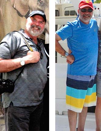 Before and After photos of a doctor who lost 44 pounds with strength training