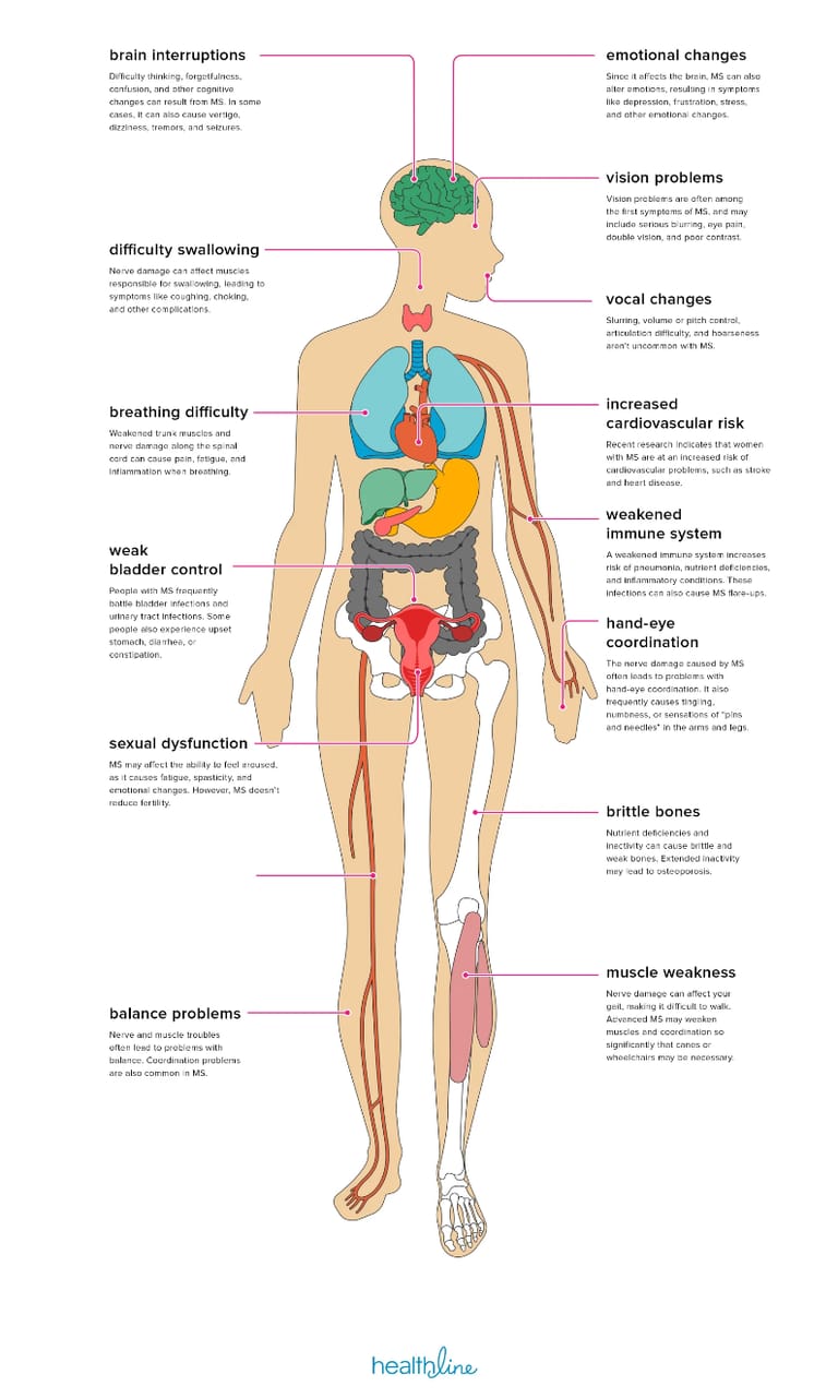 How can Strength Training help Multiple Sclerosis Diagram