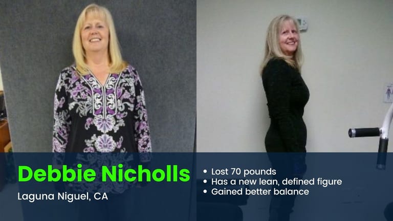 Laguna Niguel client loses 70 pounds before and after photo