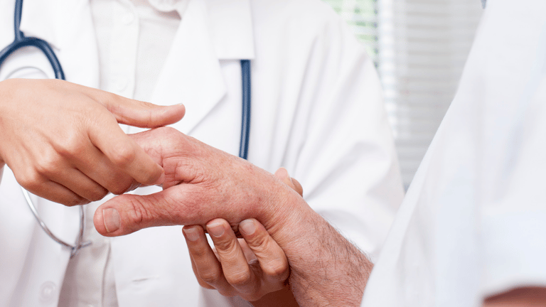 Doctor diagnosing arthritis in the hand