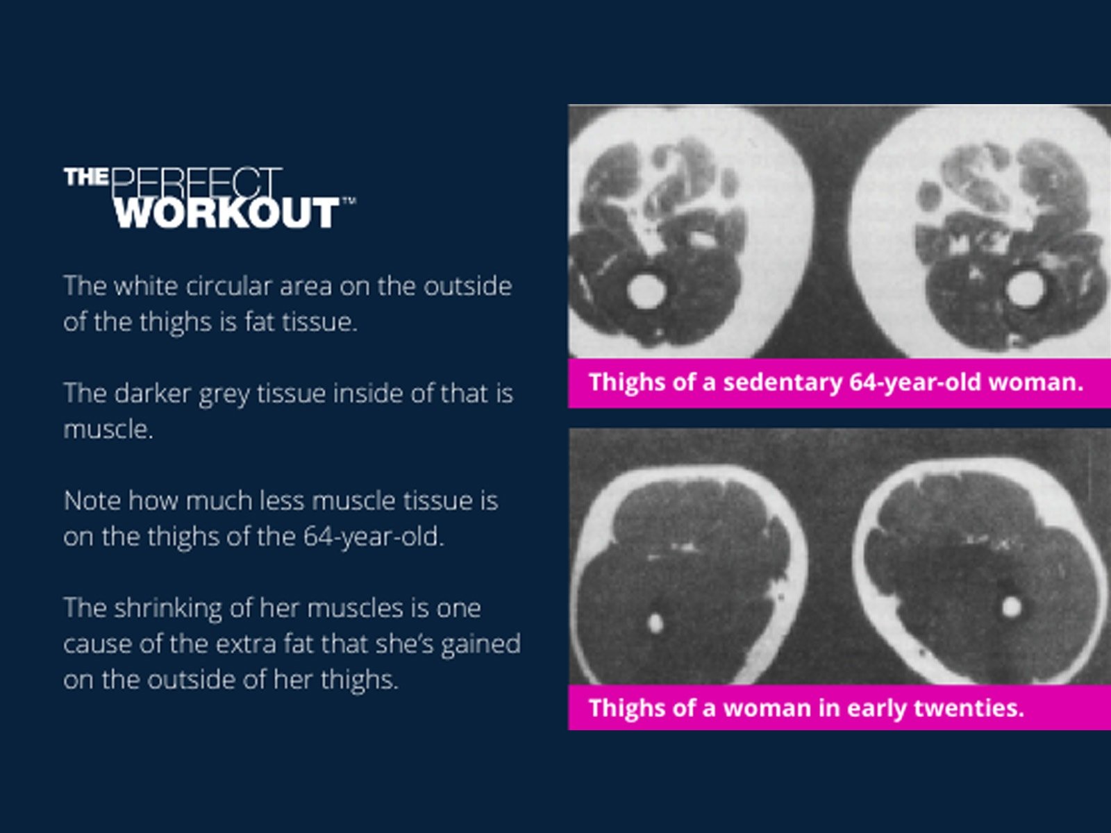 26 Sample Perfect workout menlo park for Weight Loss