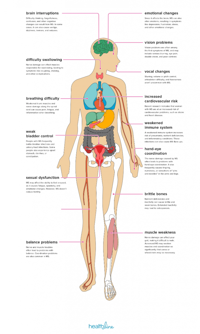 How can Strength Training help Multiple Sclerosis Diagram