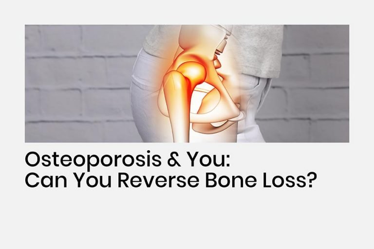 Can Osteoporosis Be Reversed - Featured Blog Image