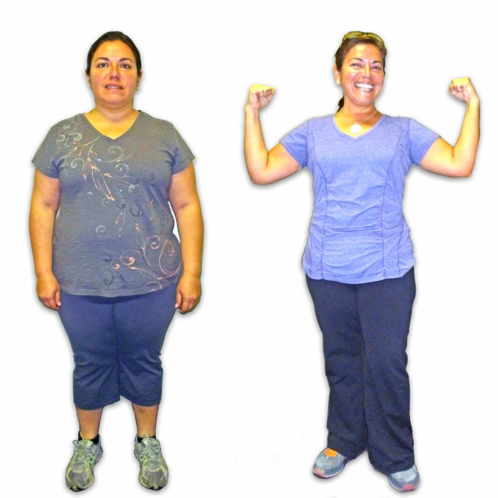 before and after photo of female client