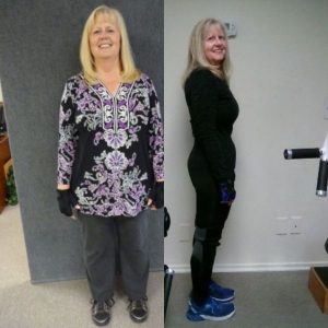 before and after results from a female client