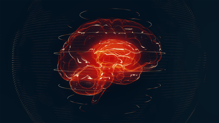 Strength Training for Parkinson's Disease Brain Anatomy