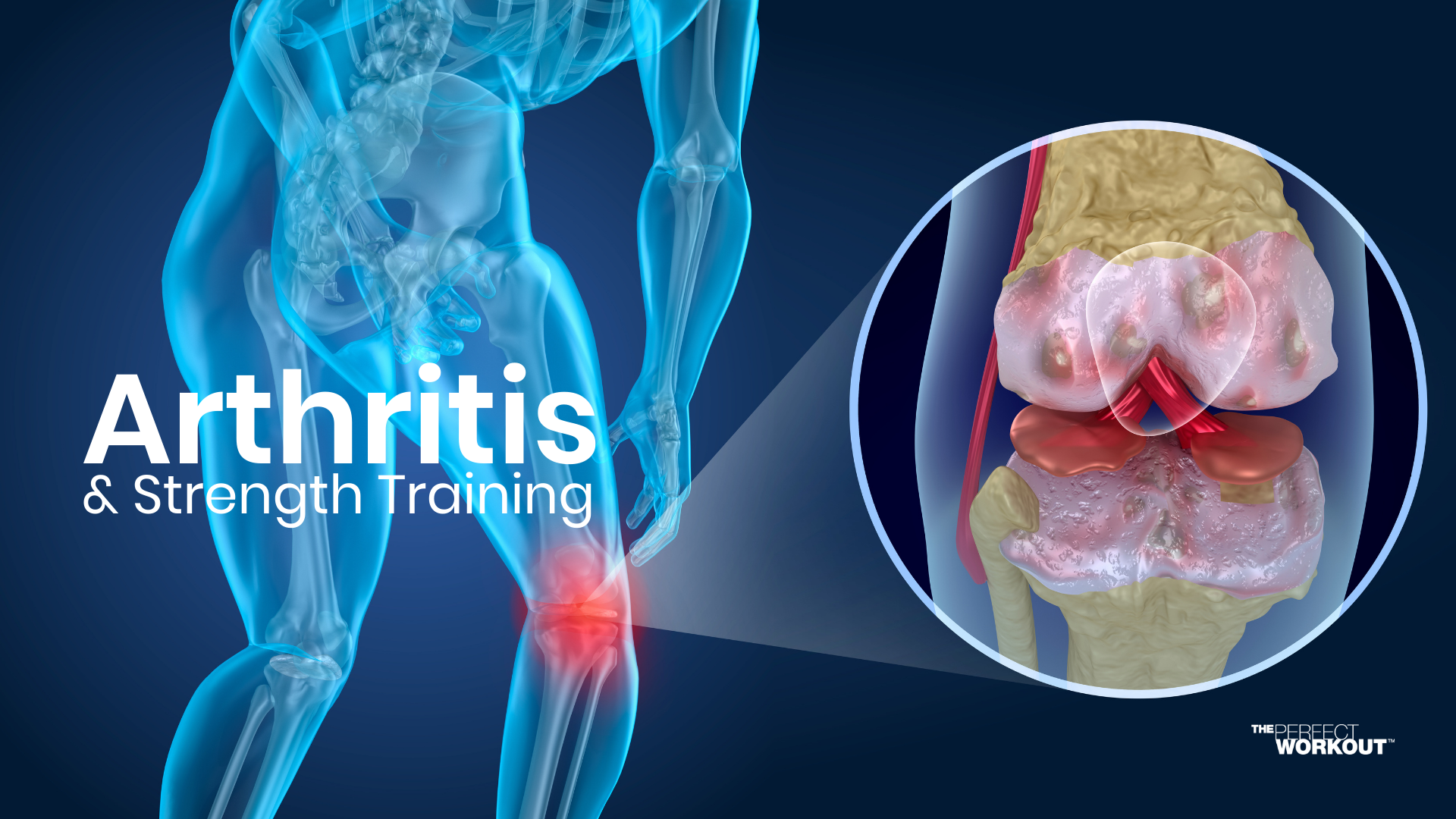 Arthritis & Strength Training The Perfect Workout