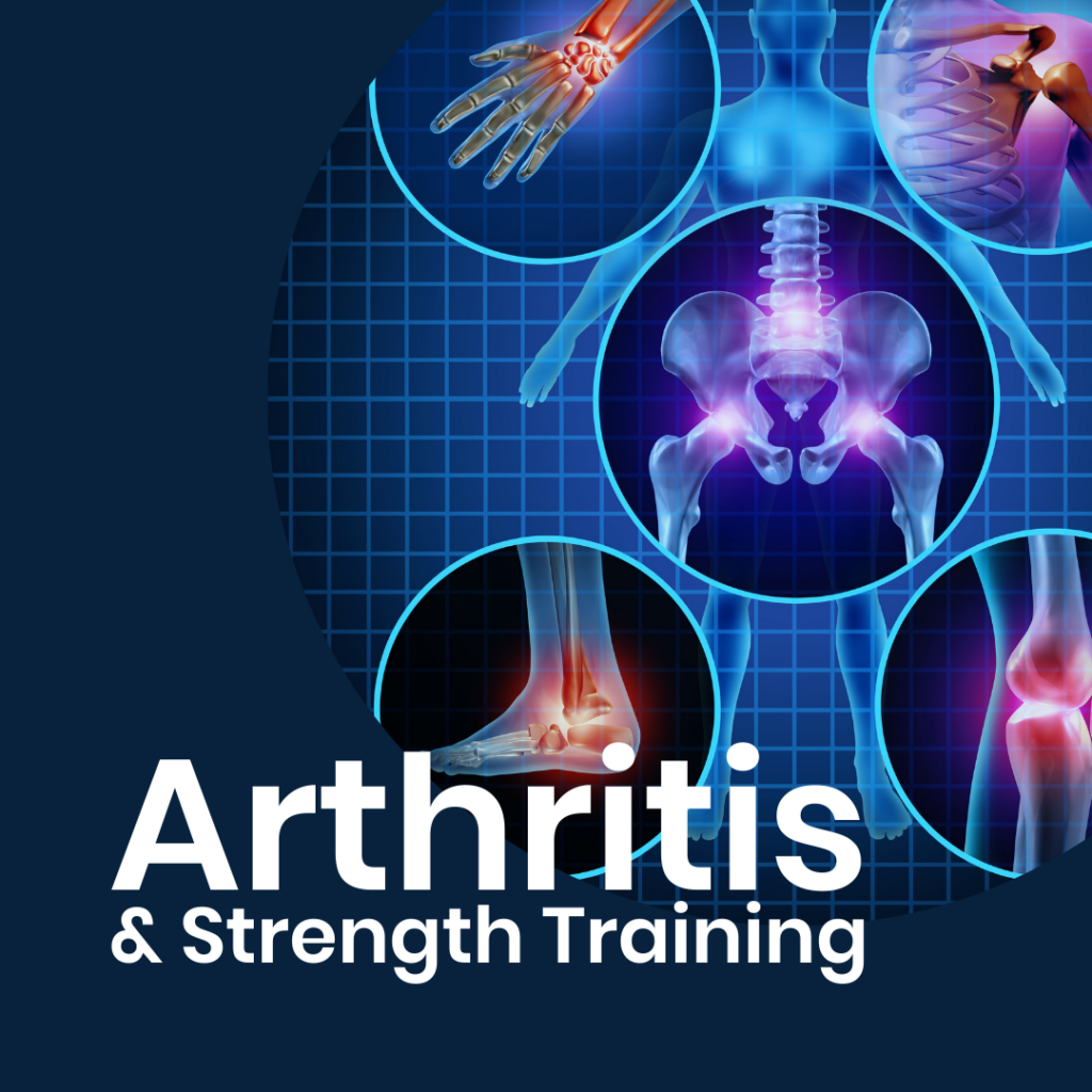 Arthritis & Strength Training anatomical image