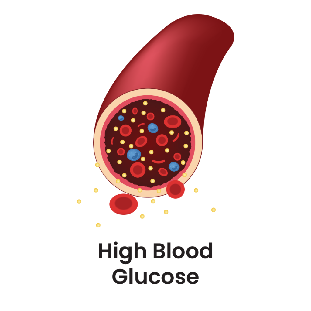 What high blood glucose looks like